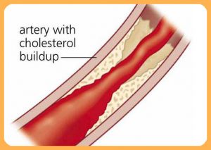 cholesterol_maho betaglucan