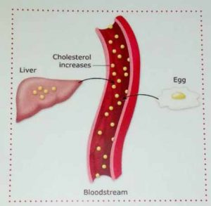 cholesterol