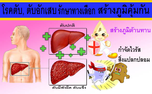liver disease -maho